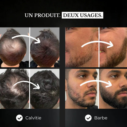 ORAN™ Effet Volume